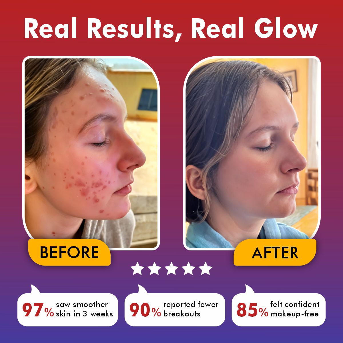 Revita Light Pro | LED Face Mask