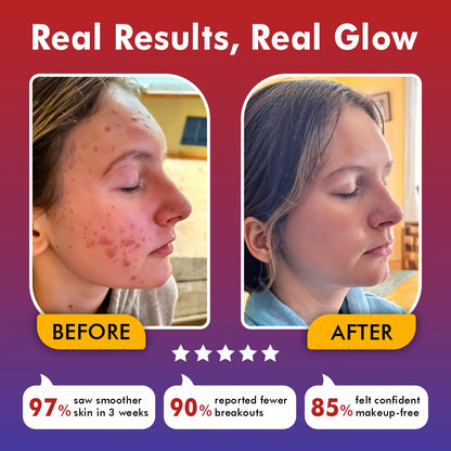 Revita Light Pro | LED Face Mask